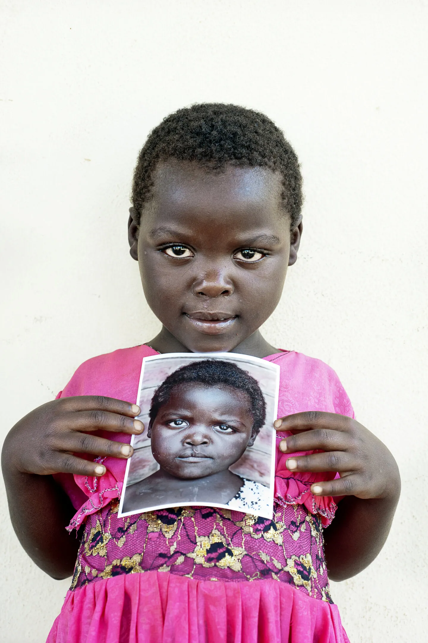 Ziyalesi holds her before photo.