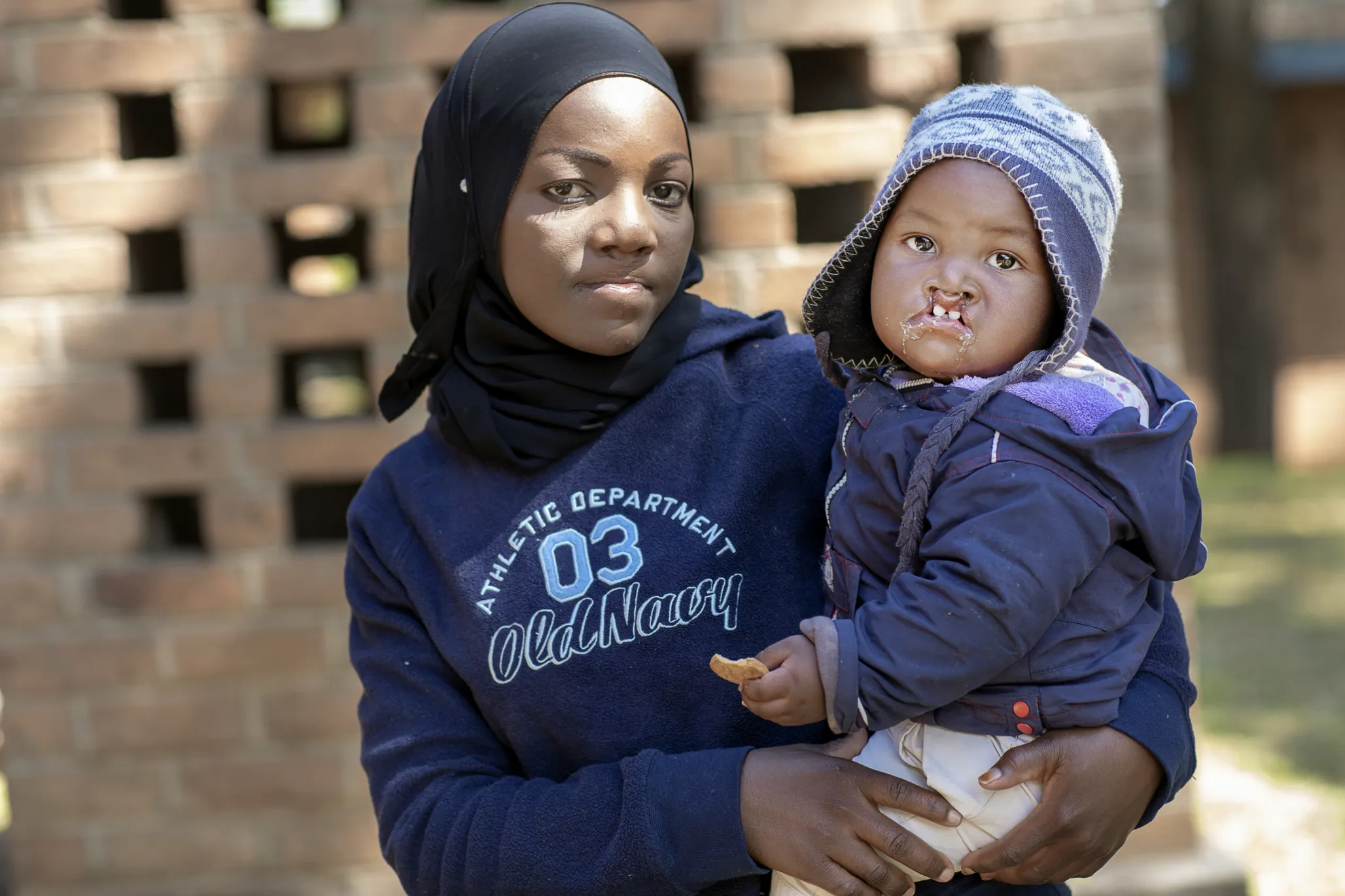 Fifteen-month Ashraf poses with his mother, Shamiem, on patient announcement day during the 2018 Operation Smile medical program to Blantyre, Malawi.