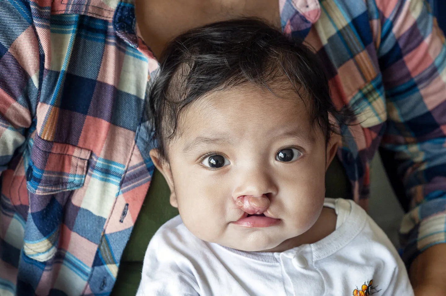 Leao, before surgery.