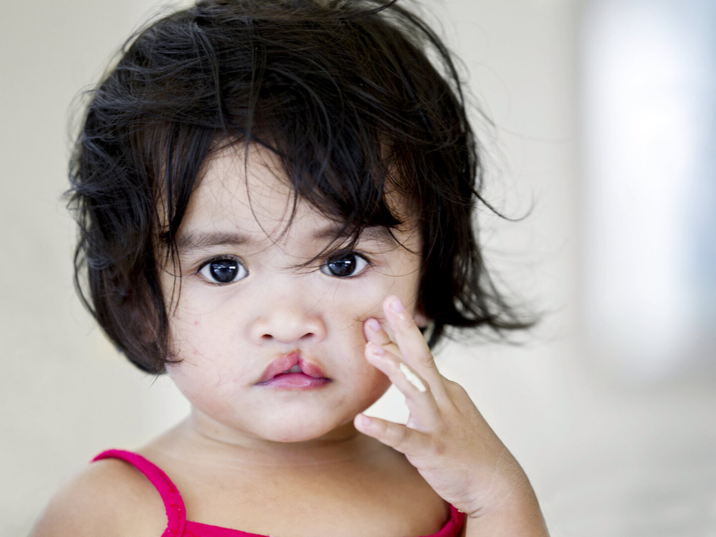 Jinden, before surgery.