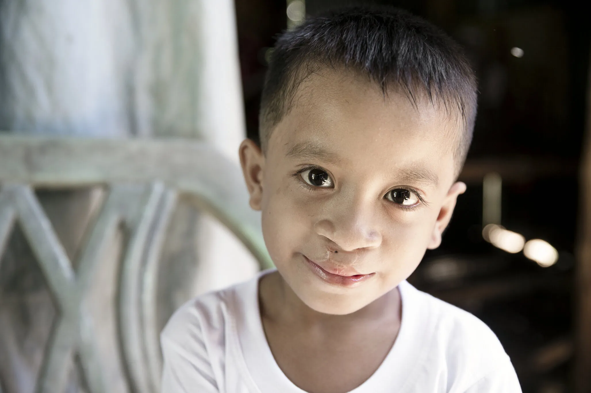 Joseph, after surgery.