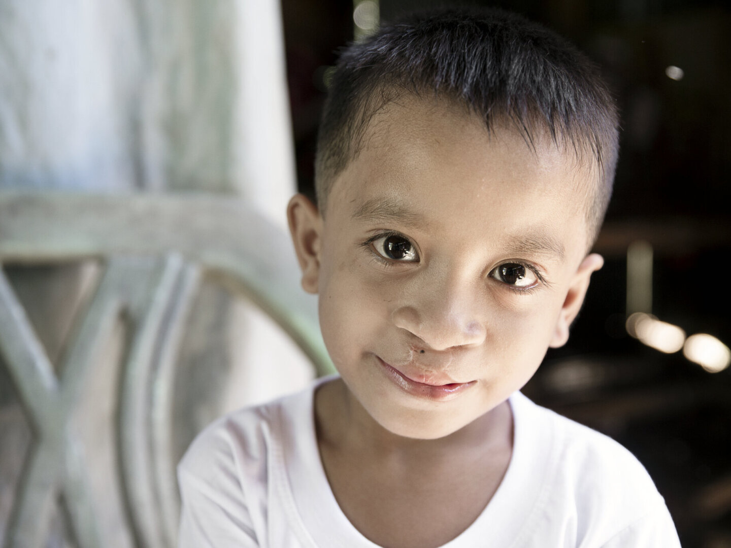 Joseph, after surgery.