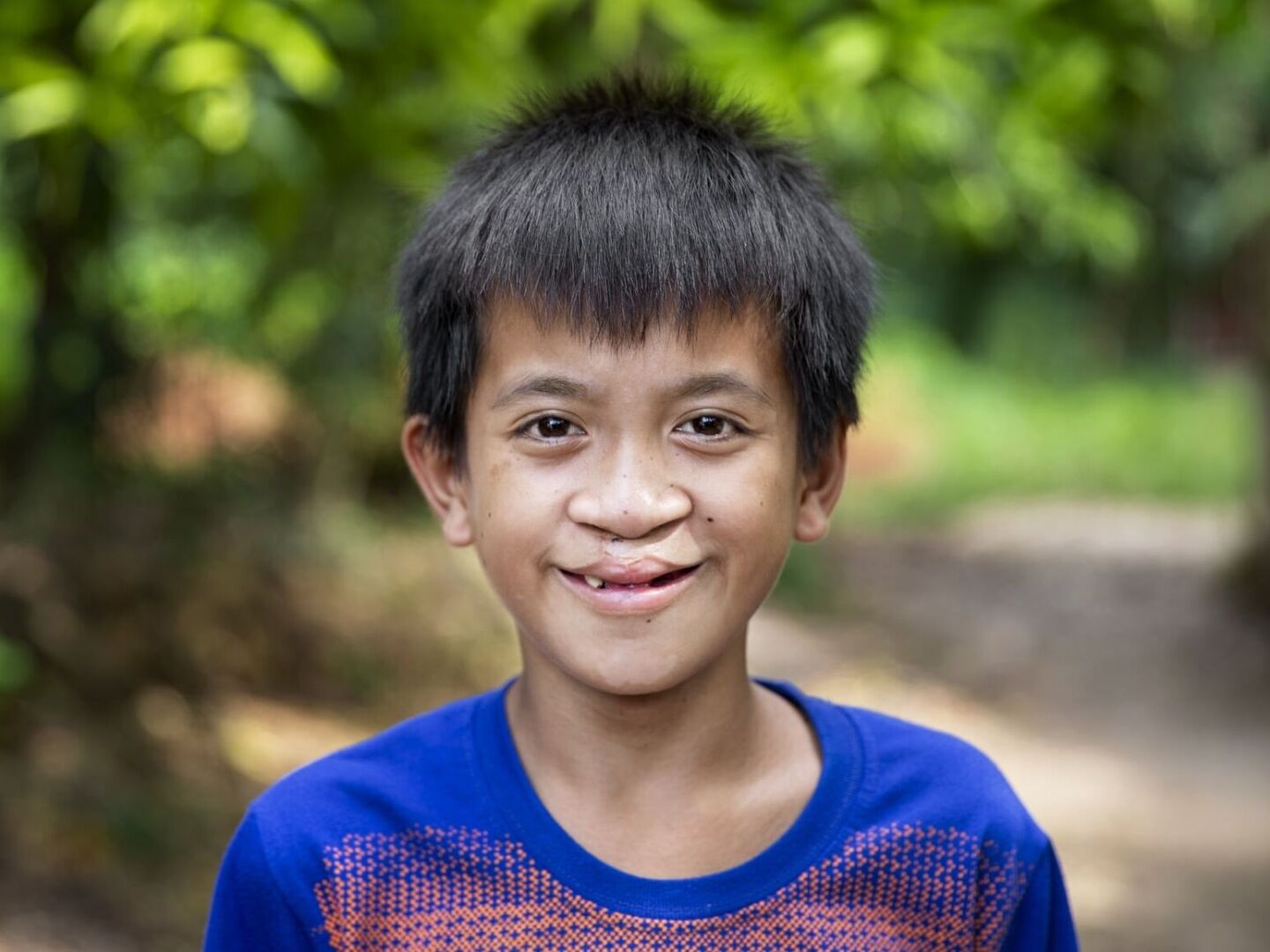 After receiving his surgery, Joseph smiles for the camera.