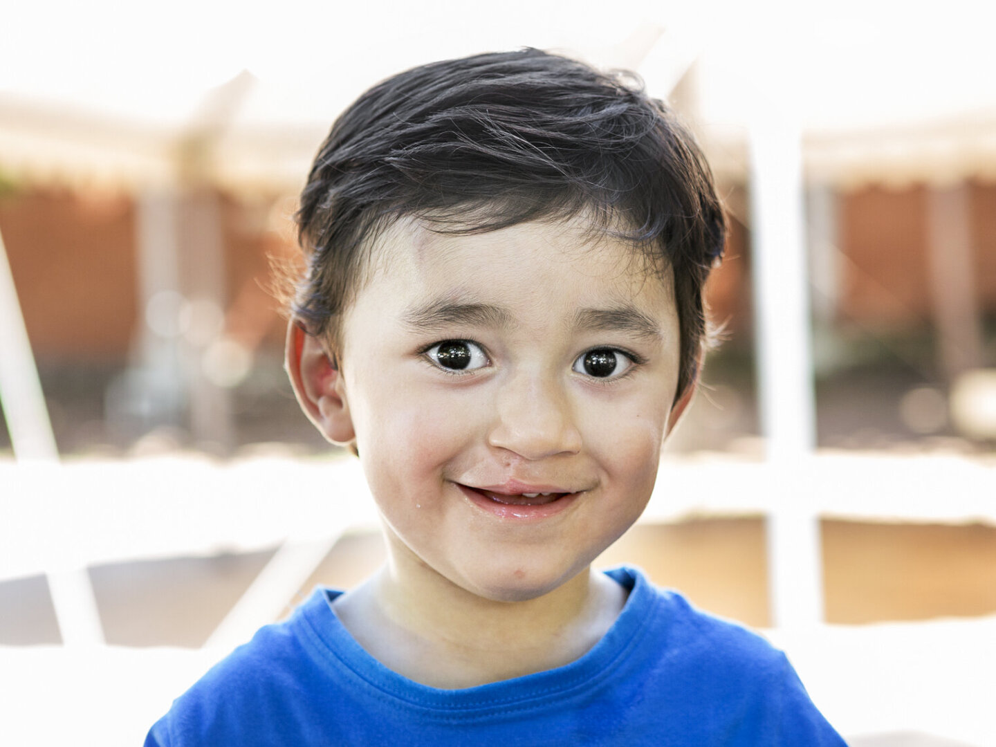 Lucas, after surgery.