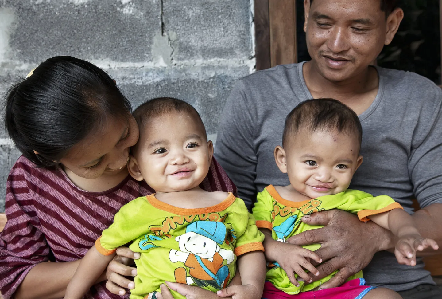 Ou, left, and Lak, one year after their cleft lip surgeries.