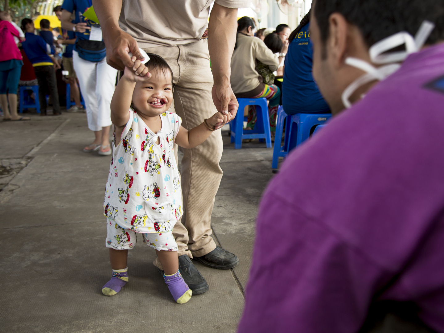 Nguyen smiles wide before surgery during a 2015 Operation Smile Vietnam surgical program.
