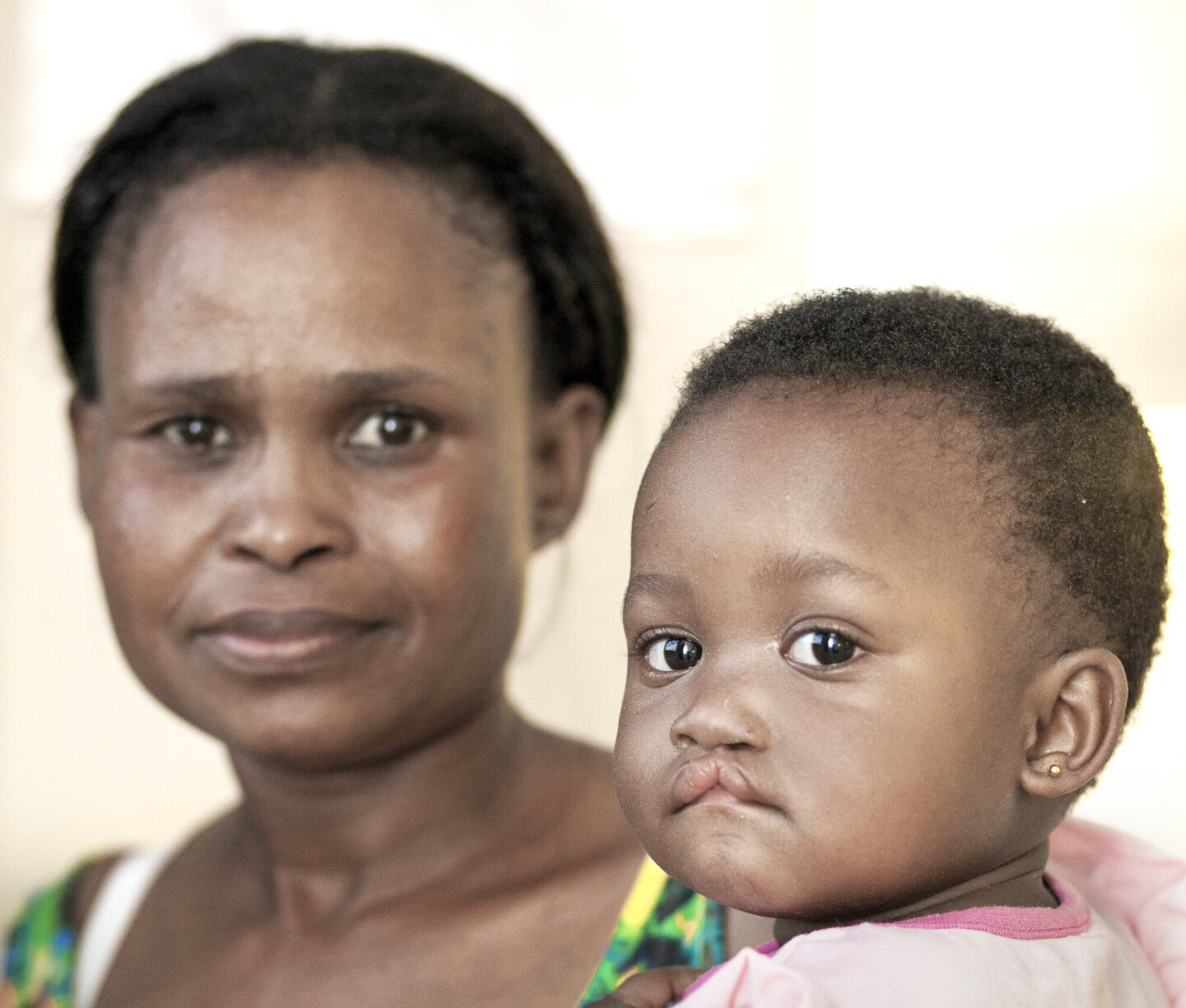 Olga and her daughter, Lungile, before surgery.