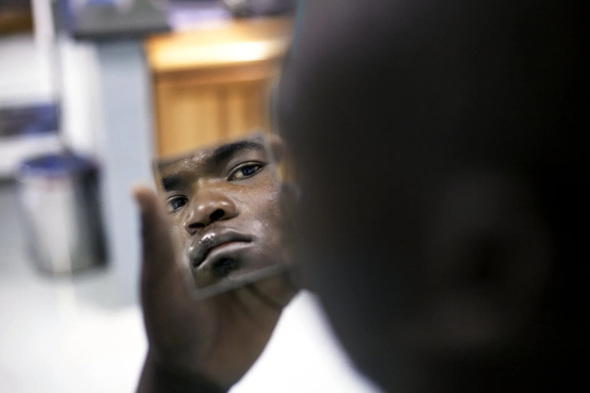 Ephraim examines his face after surgery in South Africa.