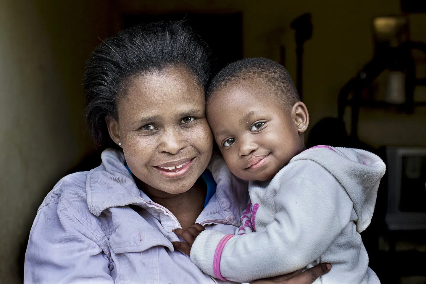 Olga and Lungile, after Lungile's cleft lip surgery.