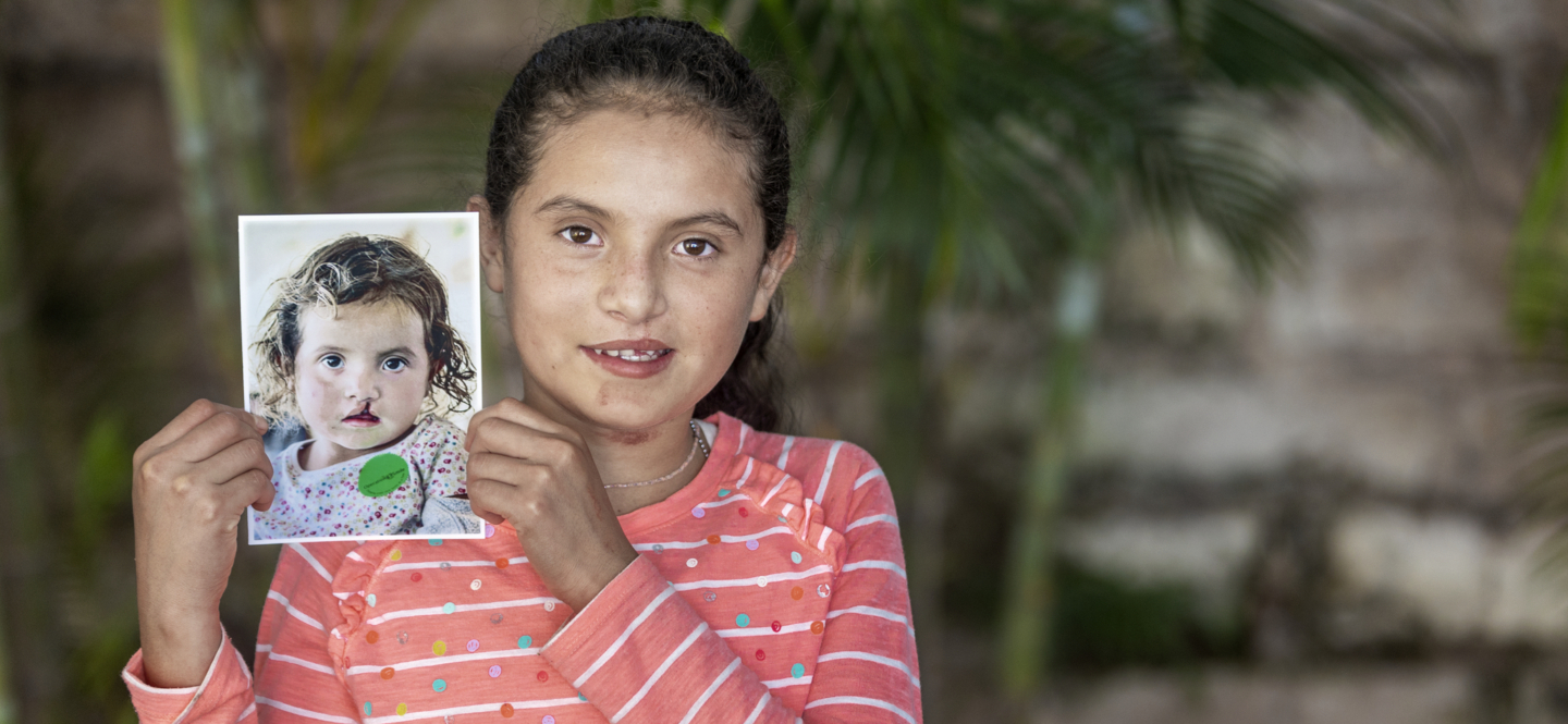 Yitci, after surgery, holds her before photos.