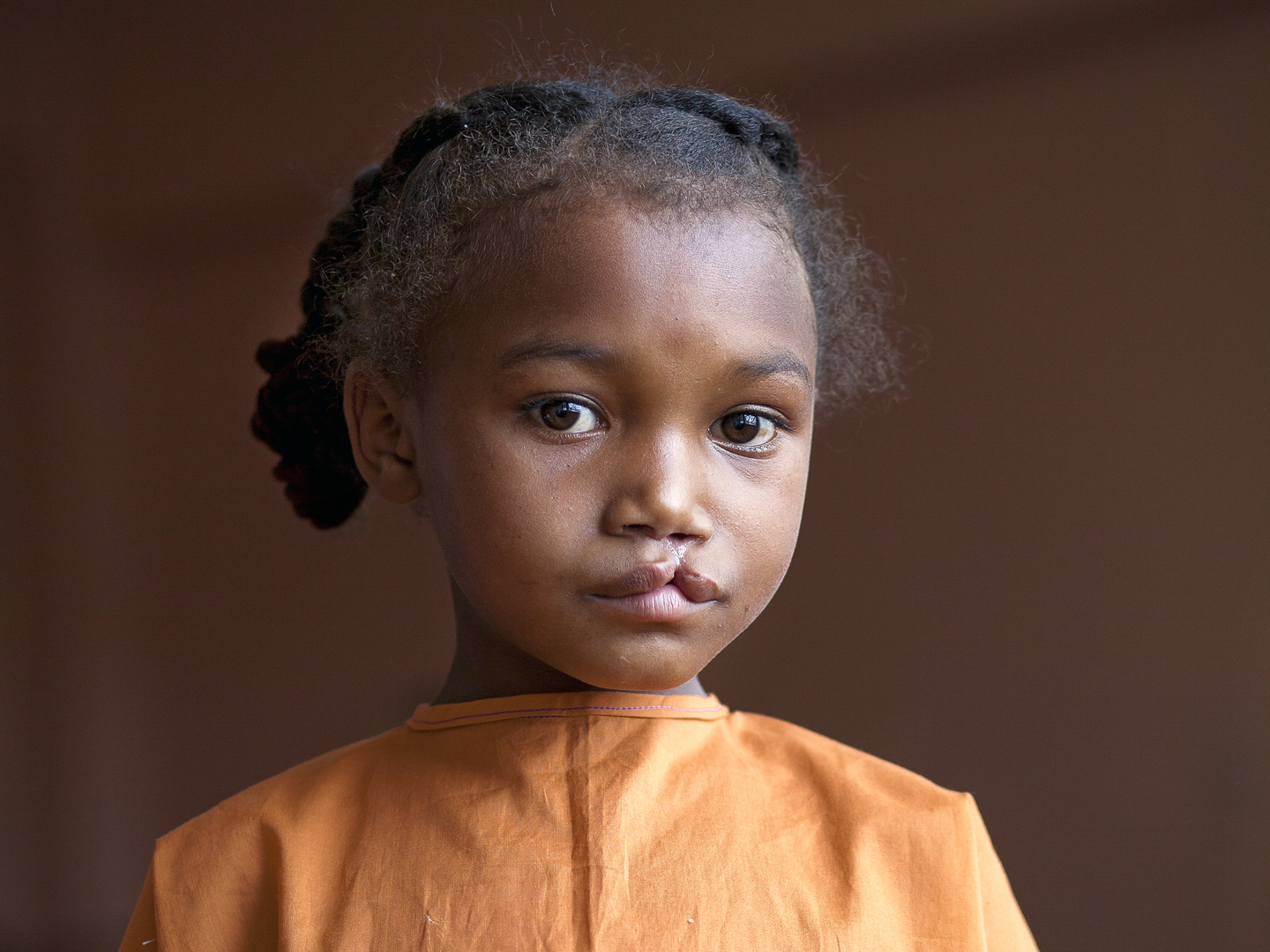 Sidonie, before surgery.