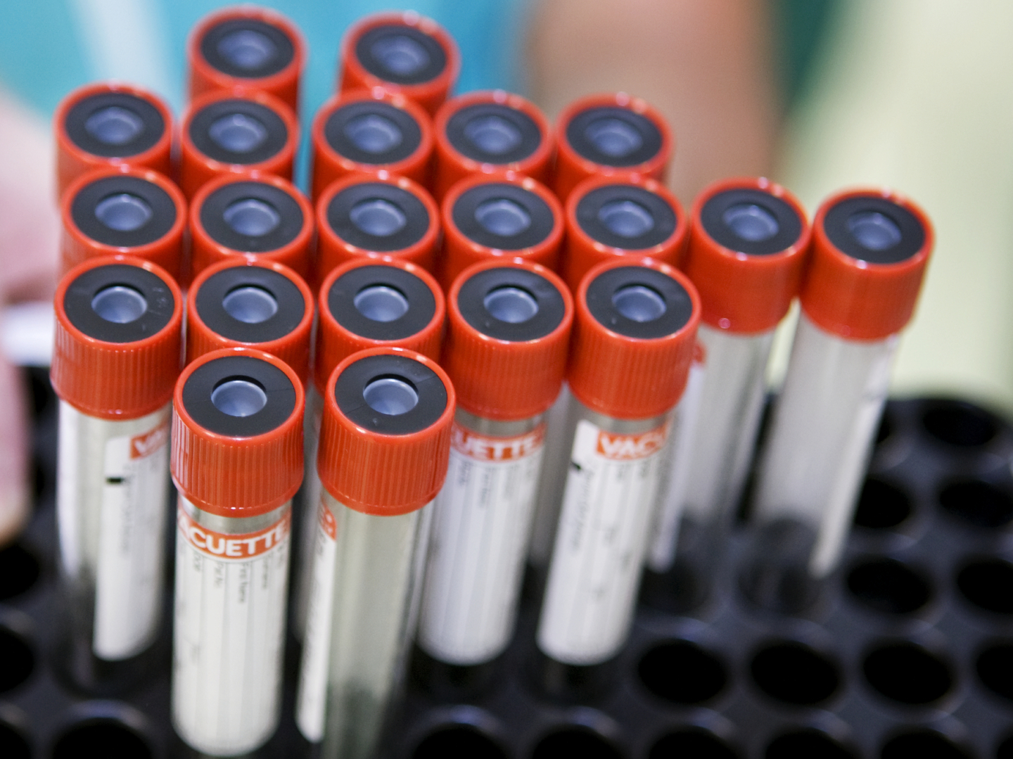 DNA Samples