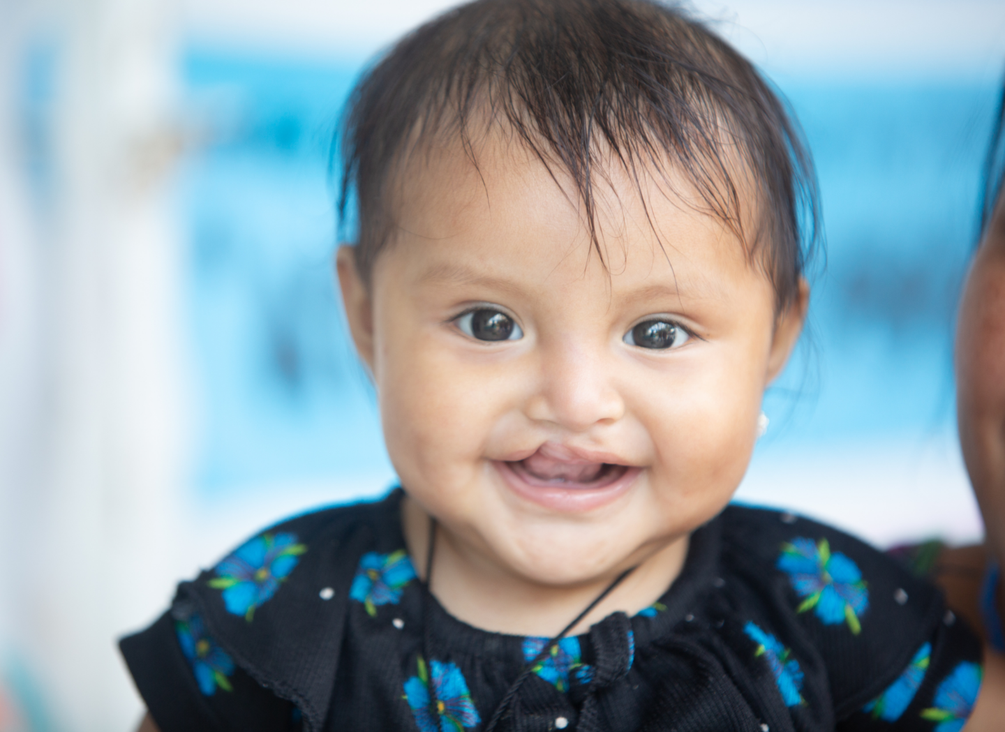 Melinda smiles before her surgery.