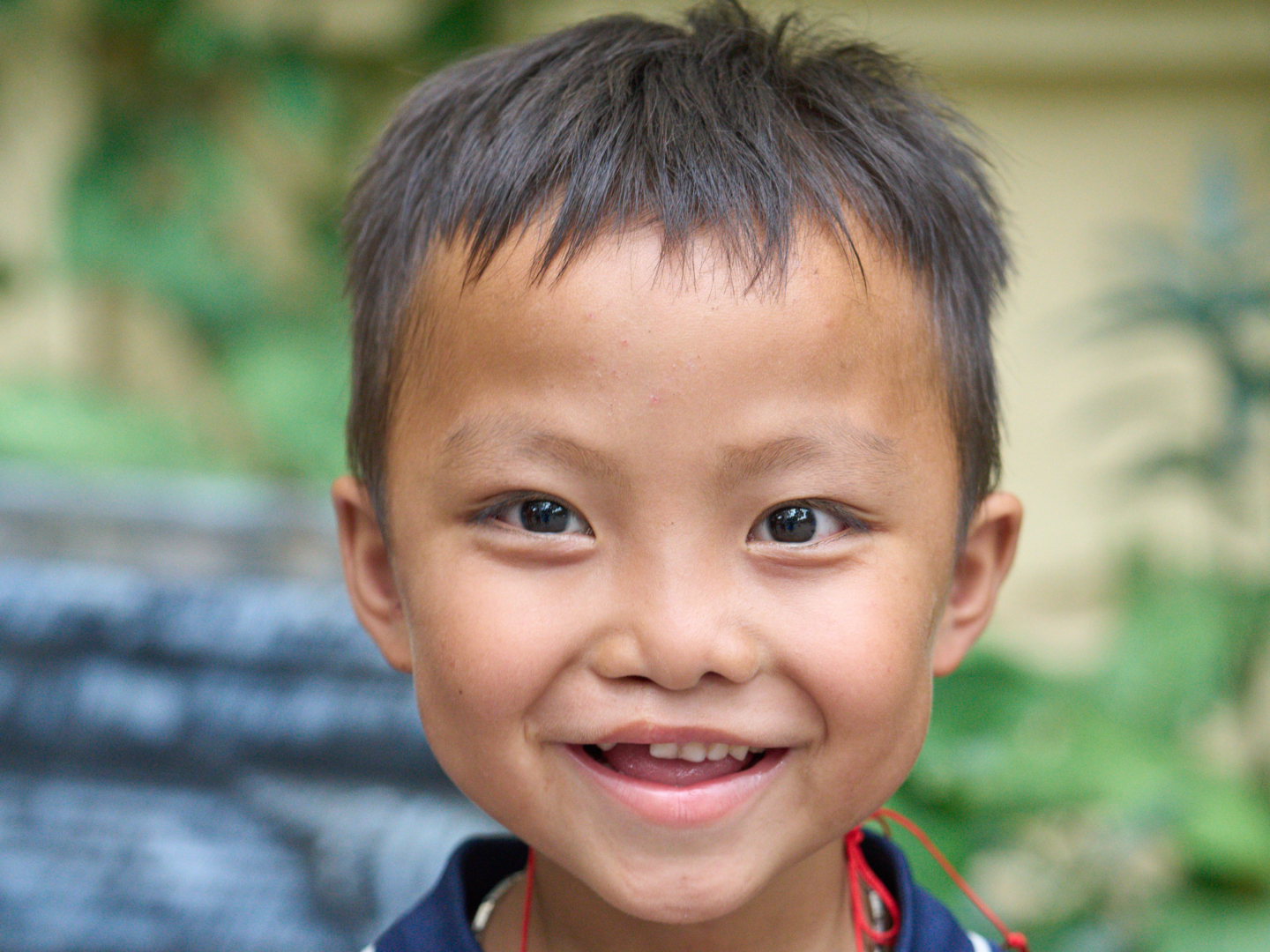 A patient smiles during a surgical program in Vietnam.