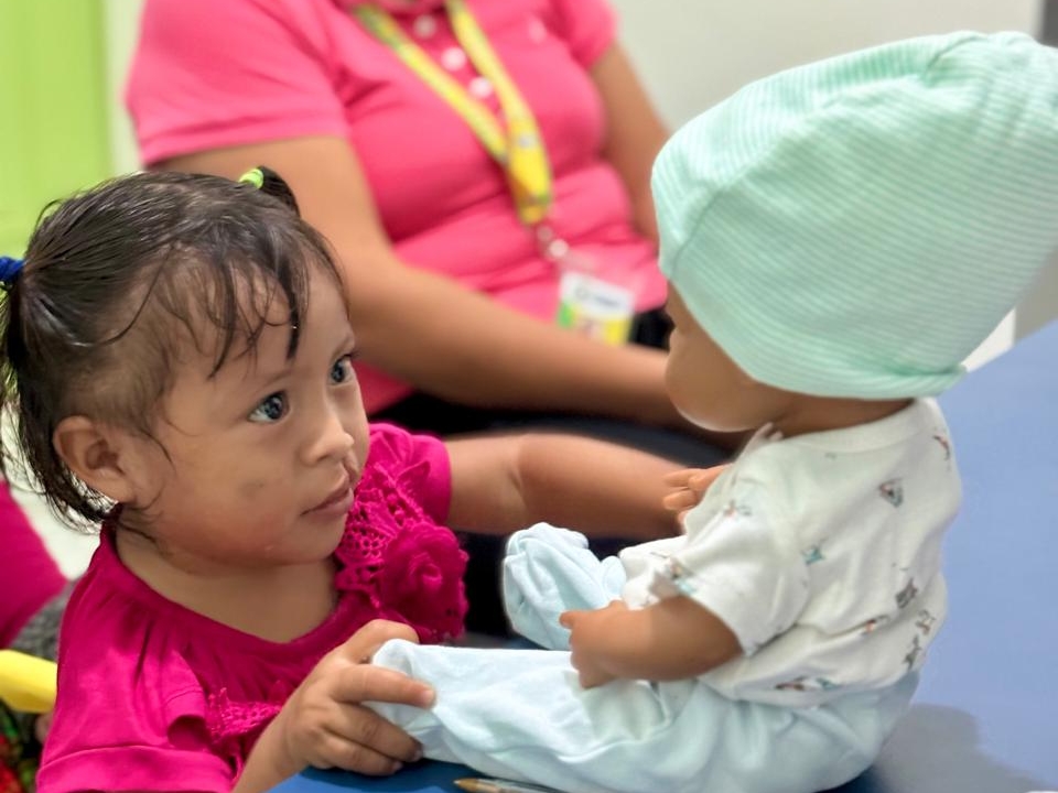A patient looks a cleft doll in Guatemala.