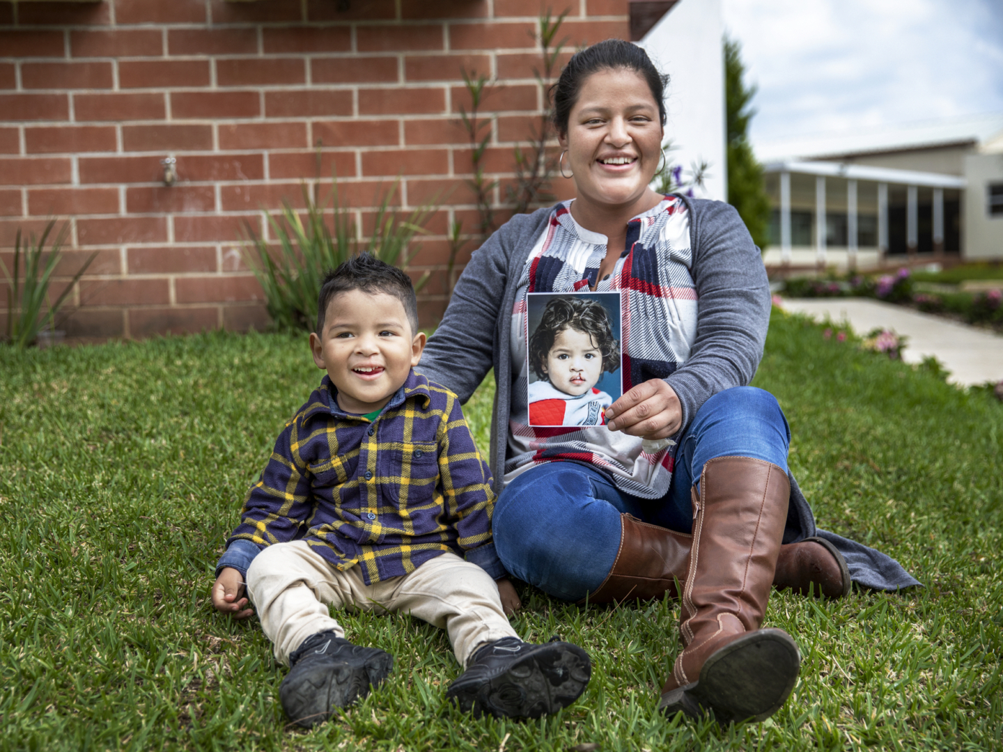 Dilan with his mom, Sandy, one year after cleft lip surgery.