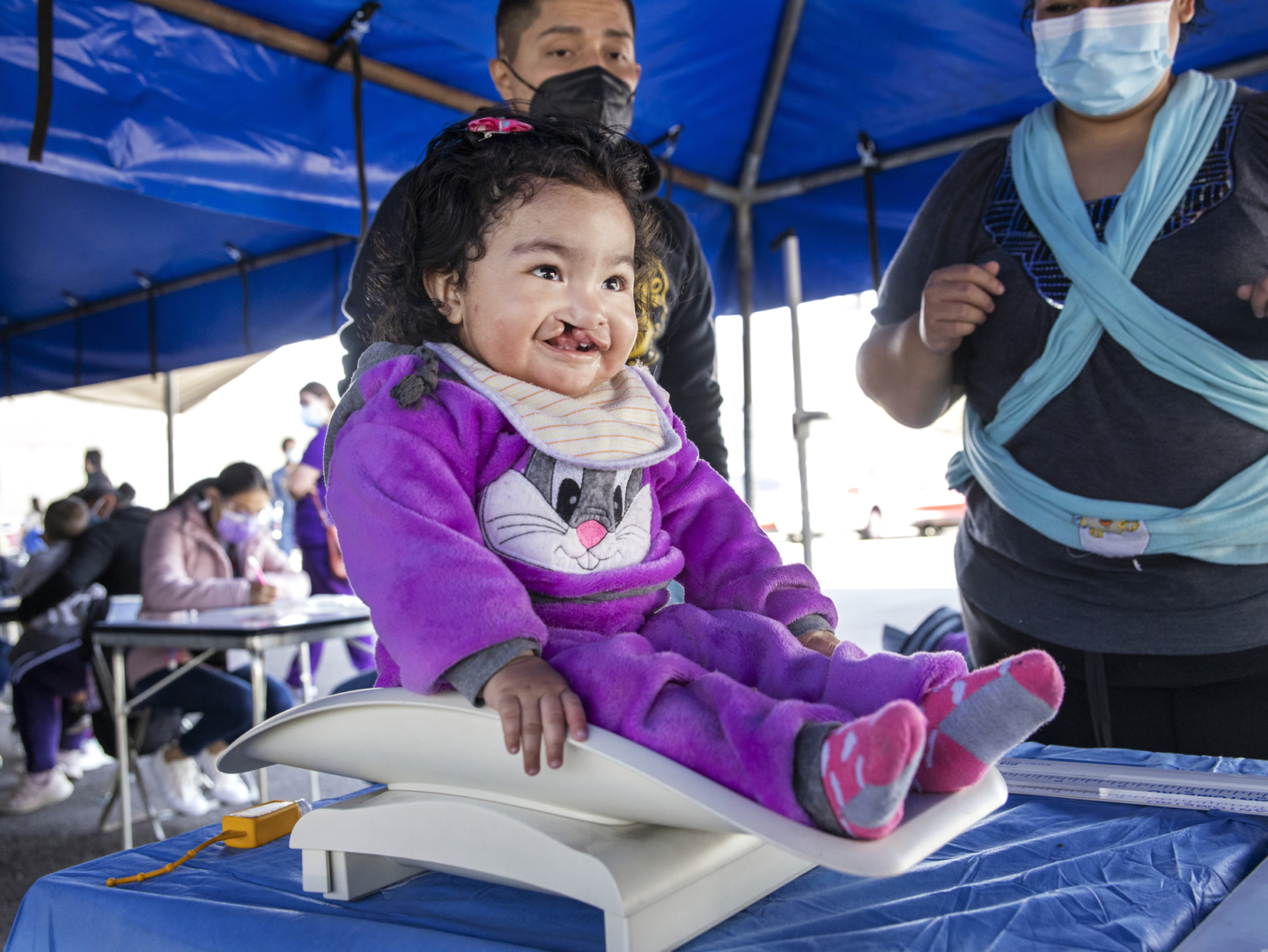 Lilia is examined by Operation Smile volunteers during a surgical program in Puebla, Mexico.