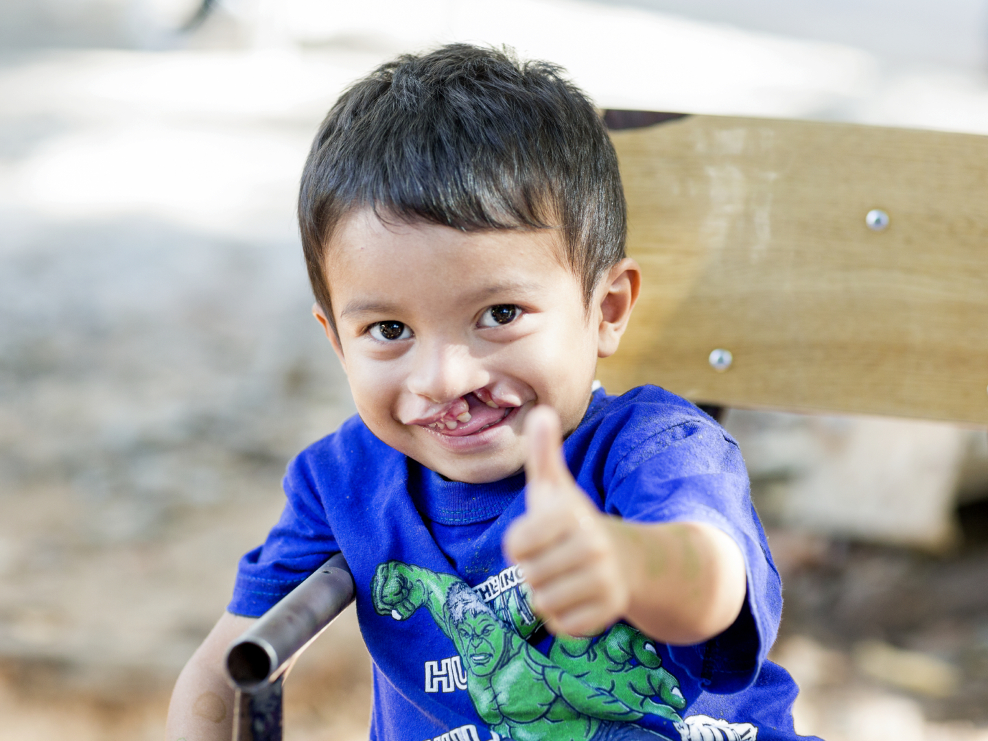A patient gives the thumbs up during a surgical program in Asuncion.