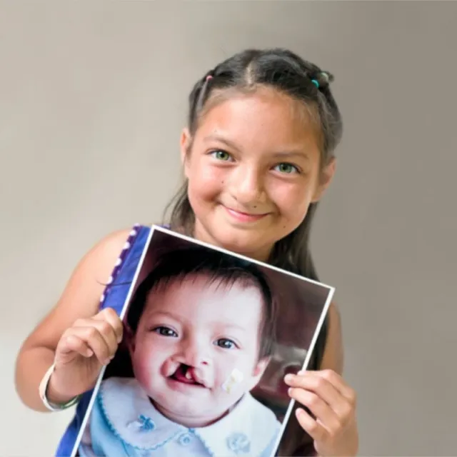 Britany, after surgery, holds her before photo.