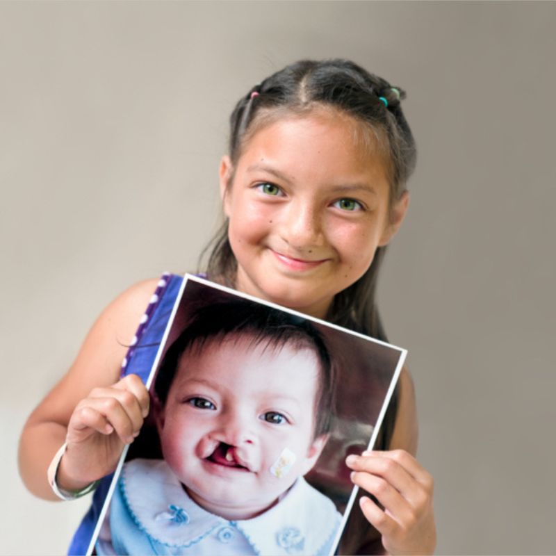 Britany, after surgery, holds her before photo.