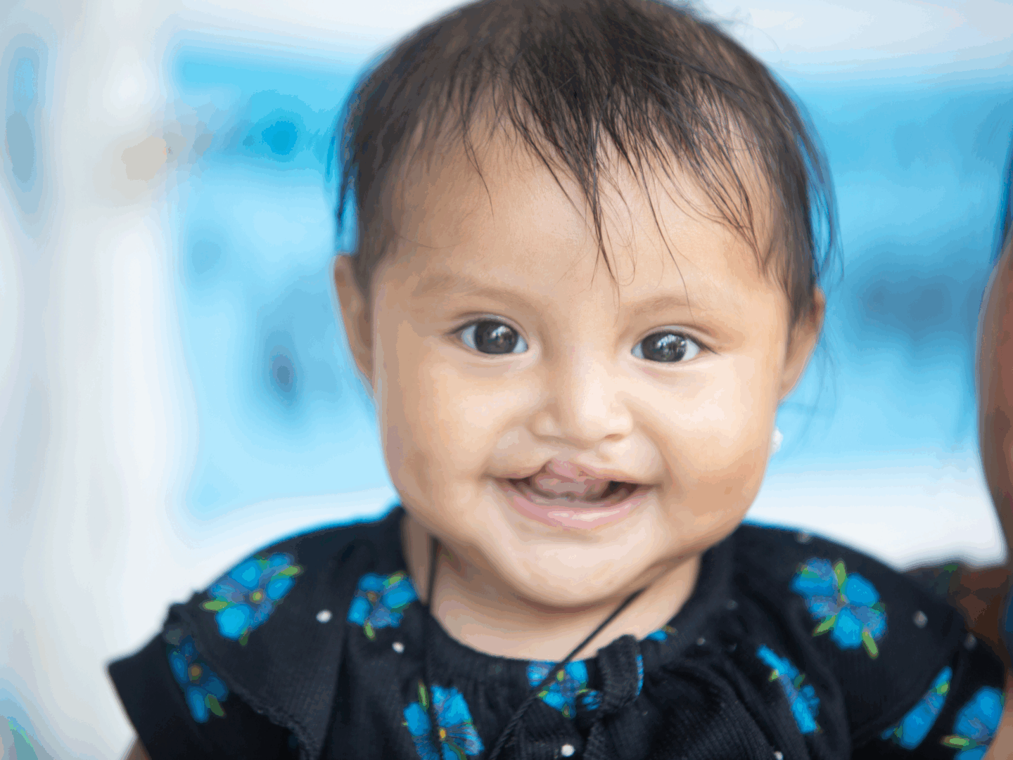 Melinda smiles before her surgery.