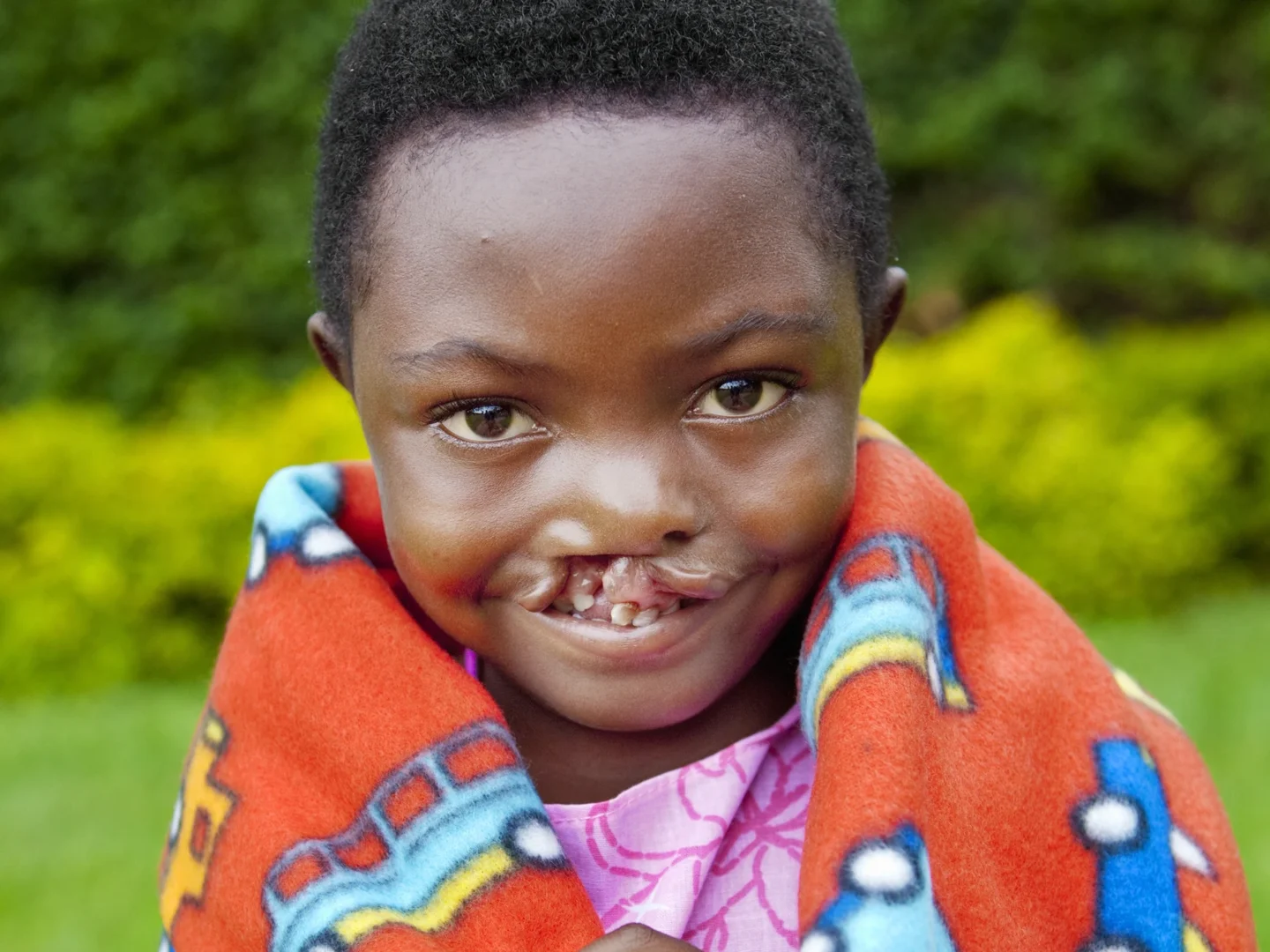 A patient holds a blanket while looking in the camera.