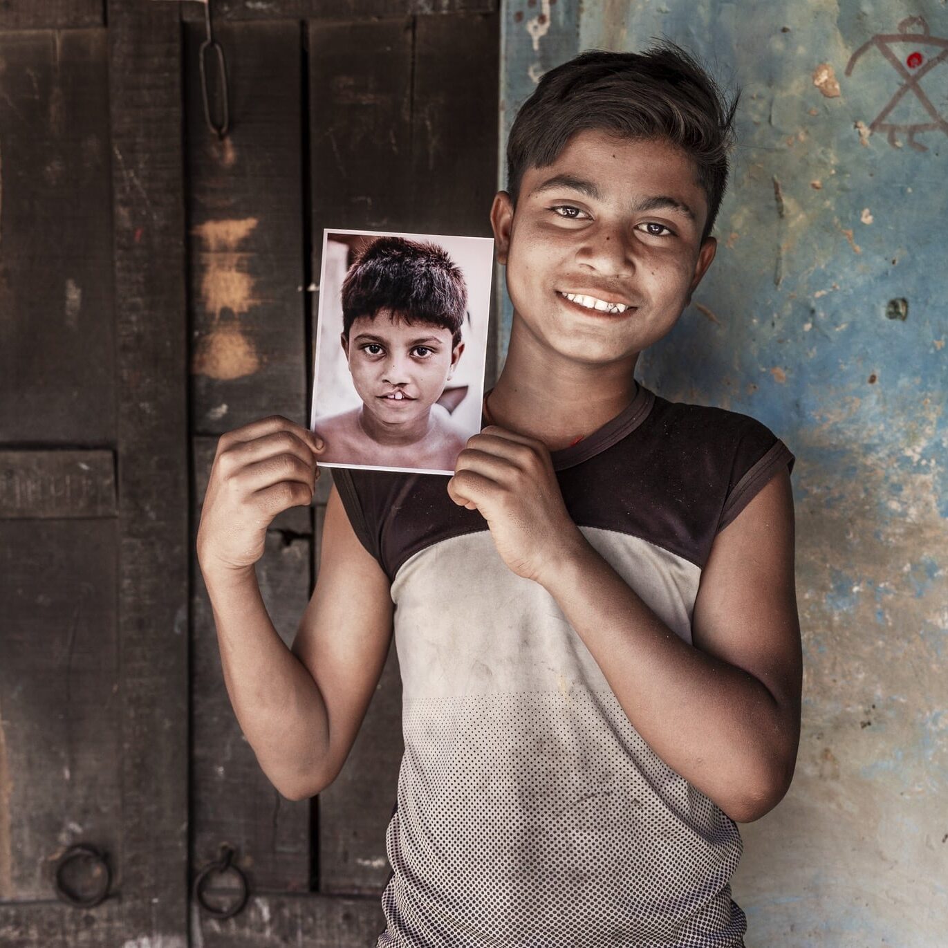 Bipul holds his before photo while smiling for the camera.