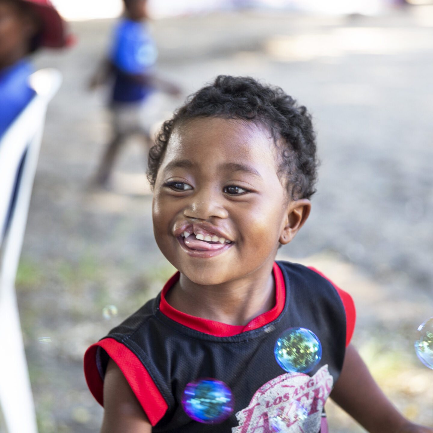 Leana, 2 years old, plays with bubbles at a surgical program in Madagascar.
