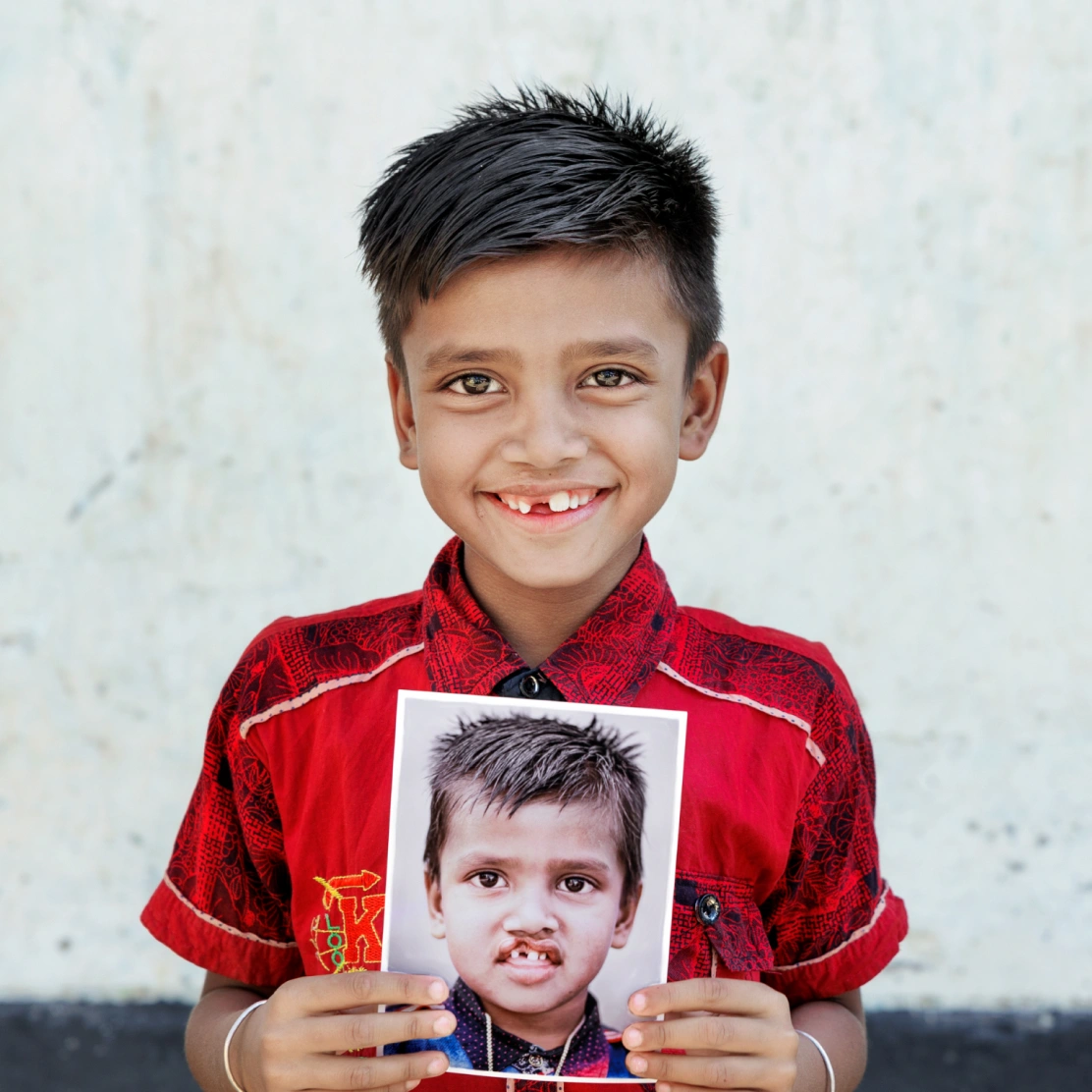 Shyam, before and after