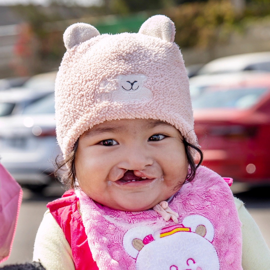 Lilia, before surgery