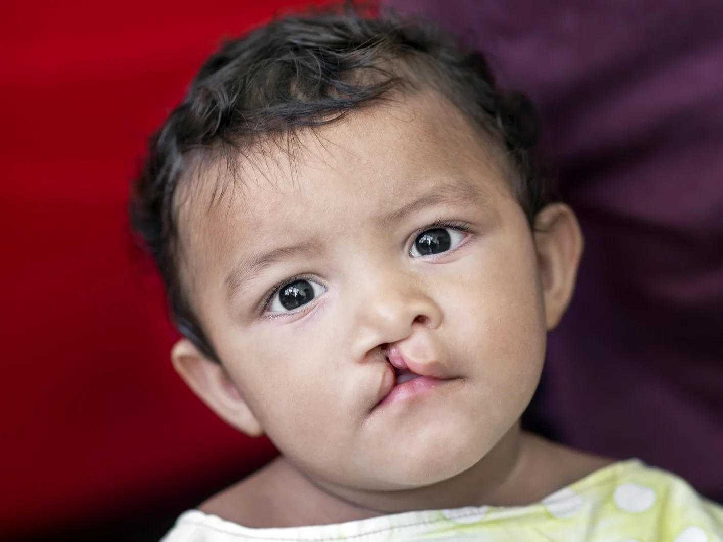 Jonathan, before surgery.