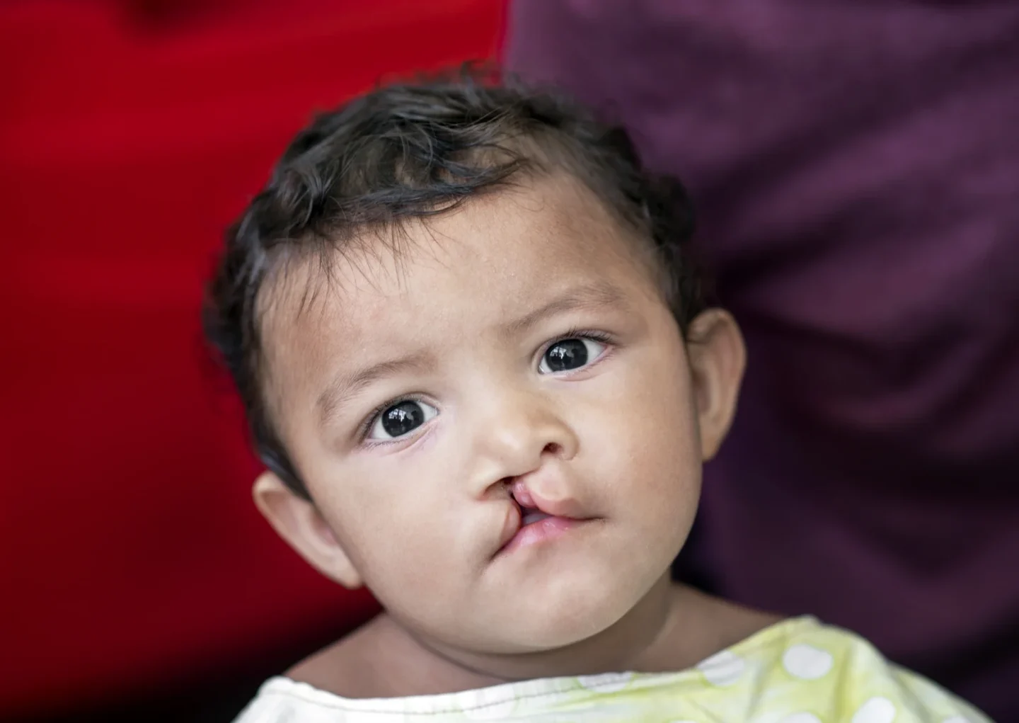 Jonathan, before surgery.