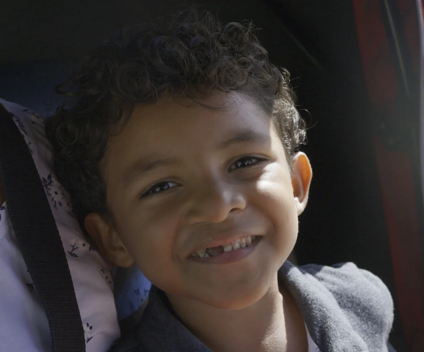 Jonathan, after surgery