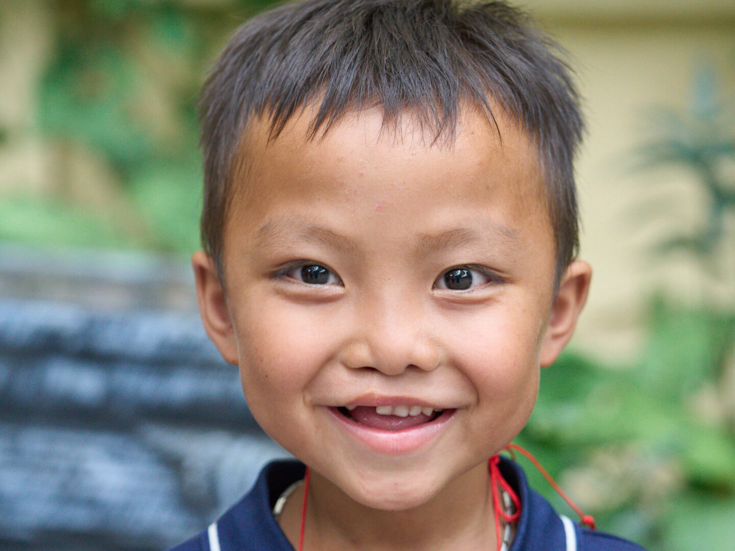 A patient smiles during a surgical program in Vietnam.