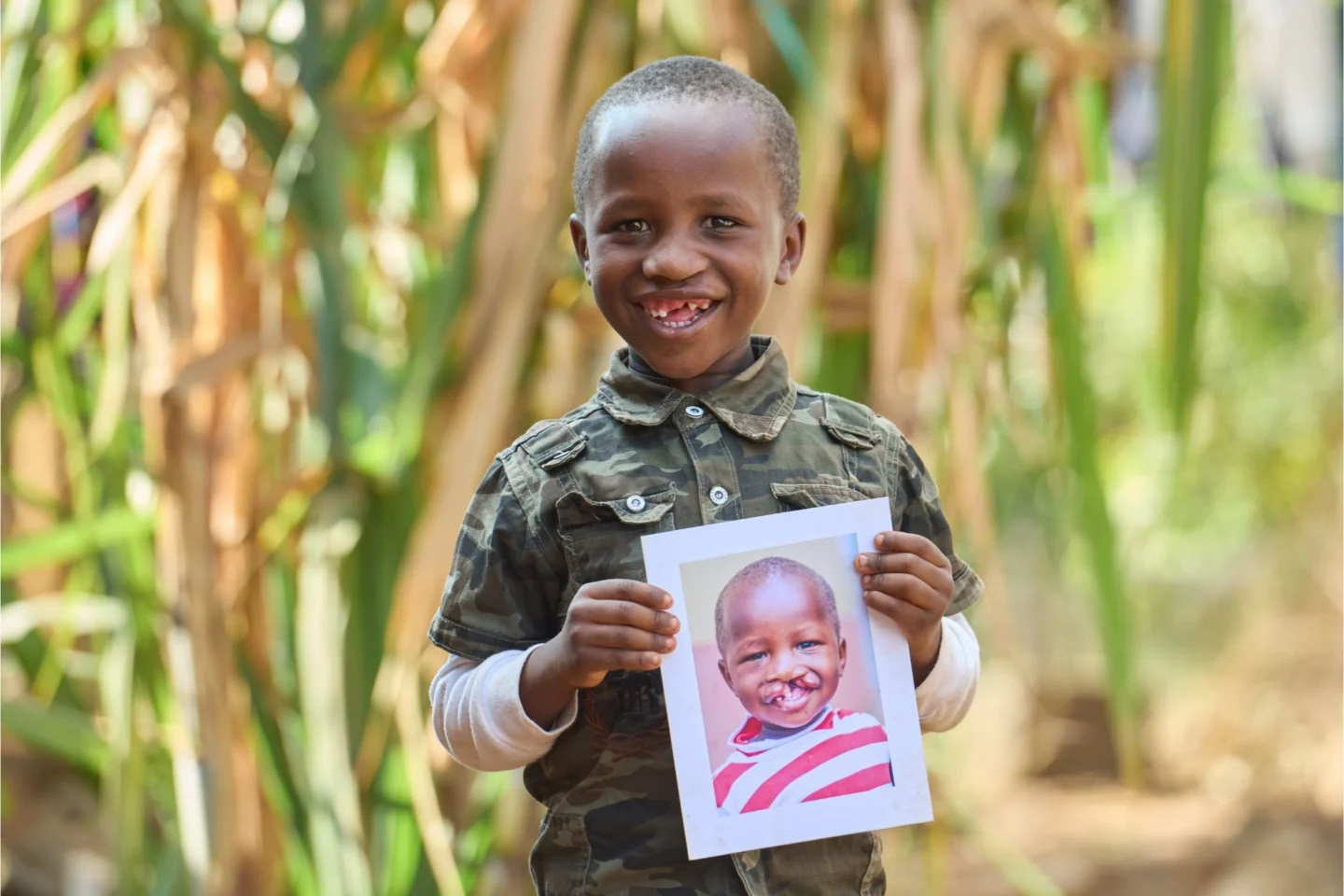 Peter, after surgery, holds his before photo.