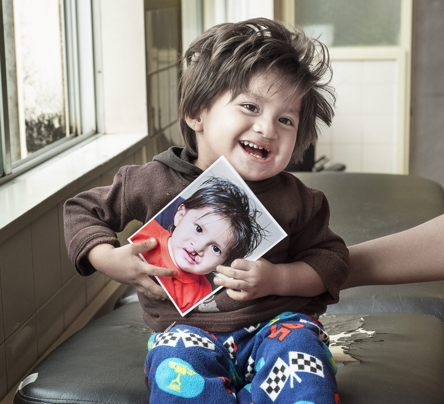 Damian, after surgery.