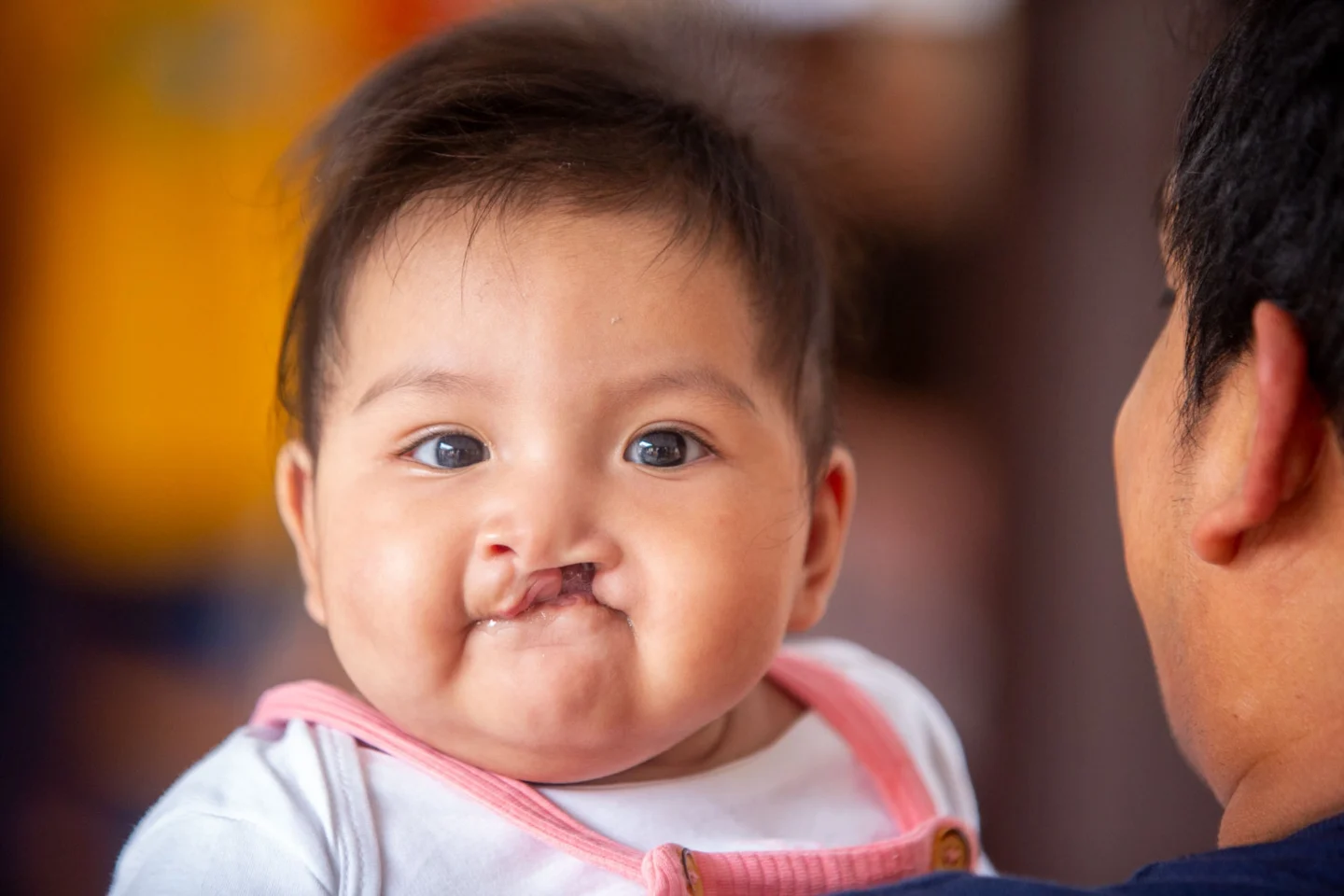Margaret, before surgery