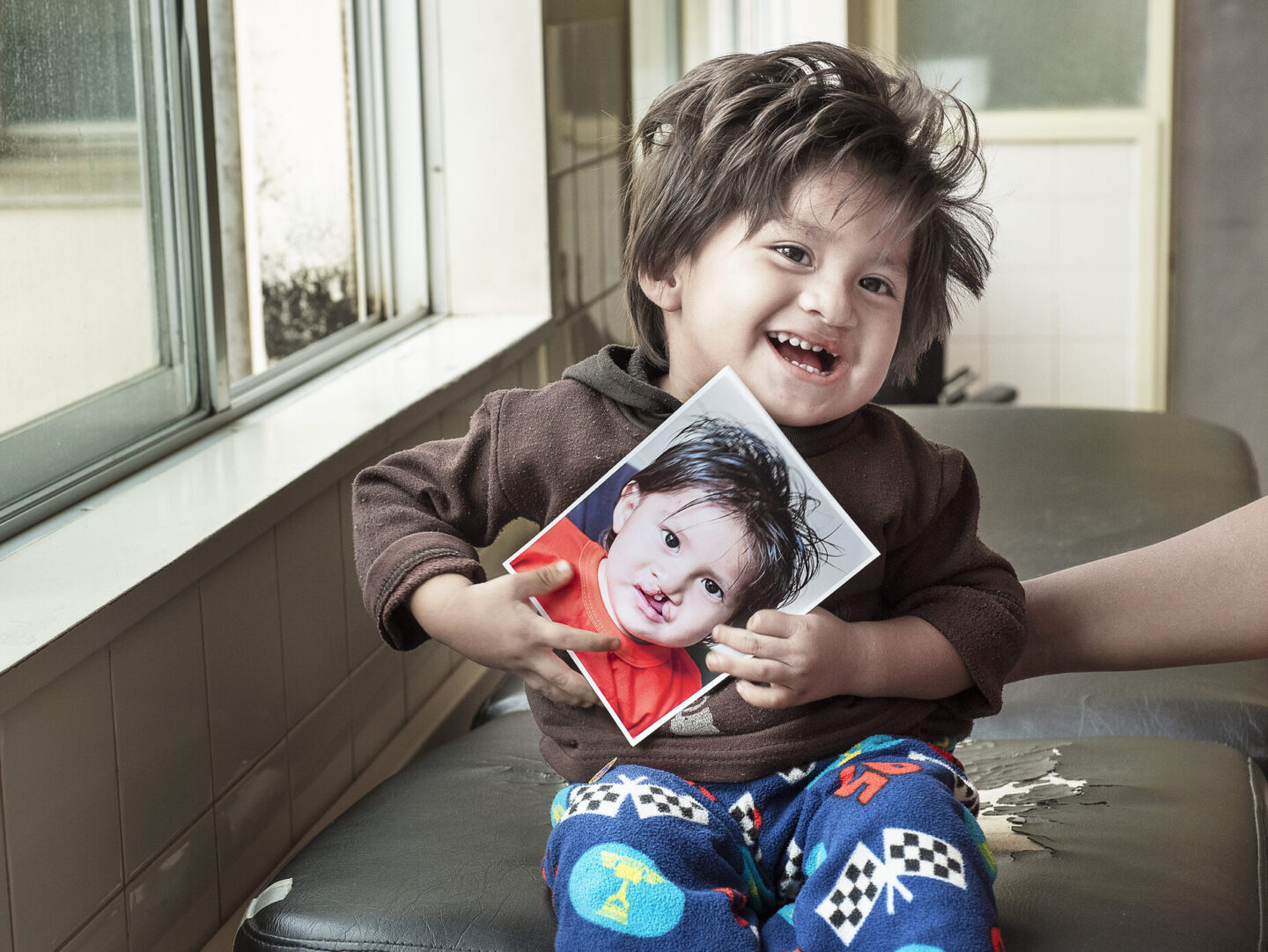 Damian, after surgery.