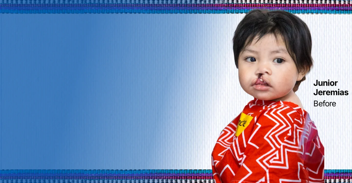 Junior Jeremias, before surgery