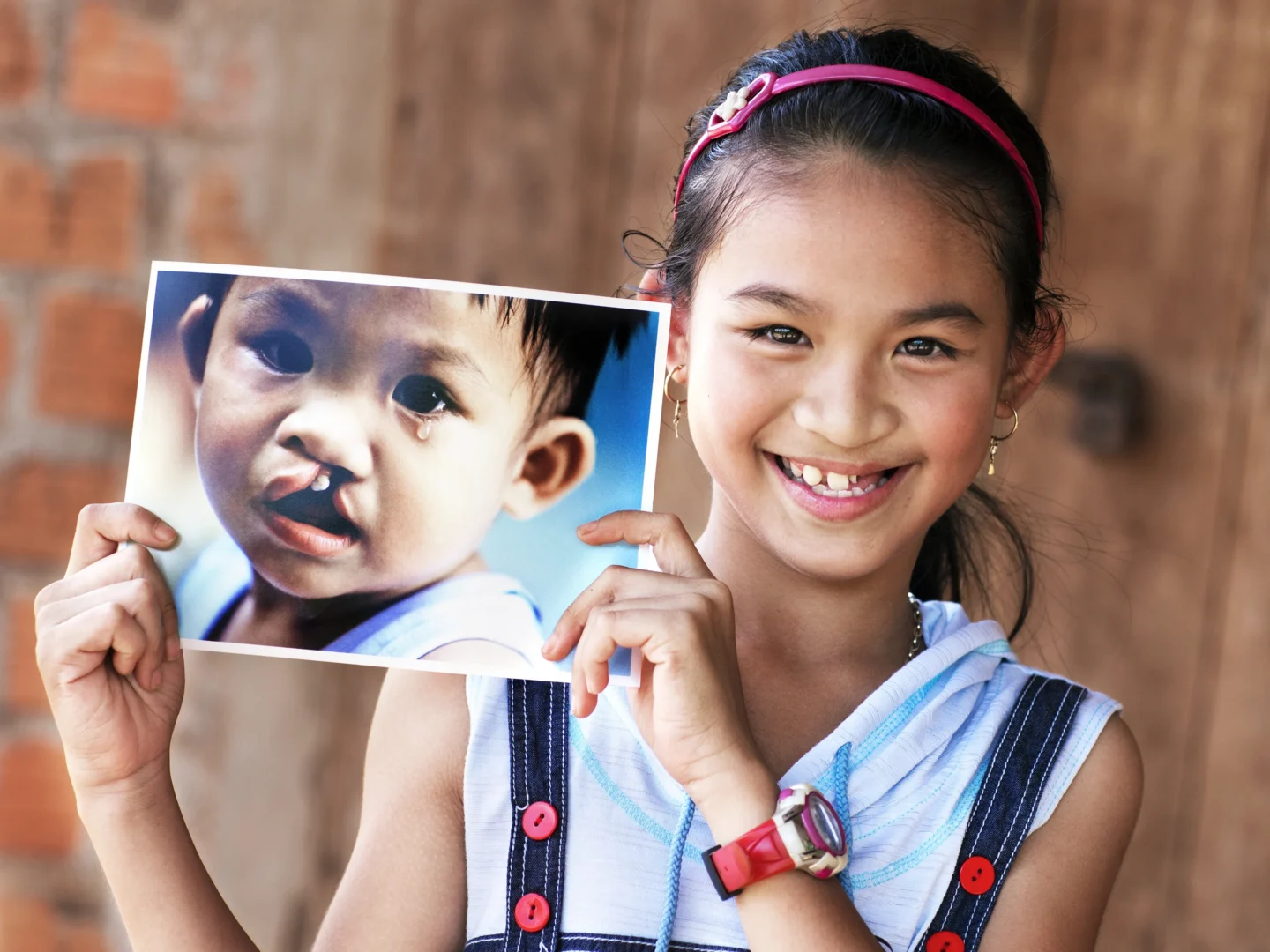 A young Vietnamese girl smiles at the camera while holding a photo of herself as an infant before she received surgery for a cleft lip.