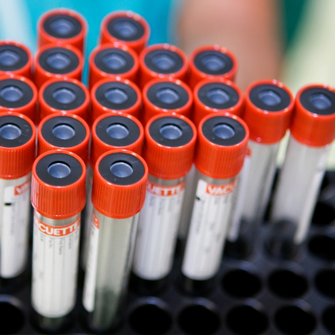 Close-up photo of test tubes with bright red caps.